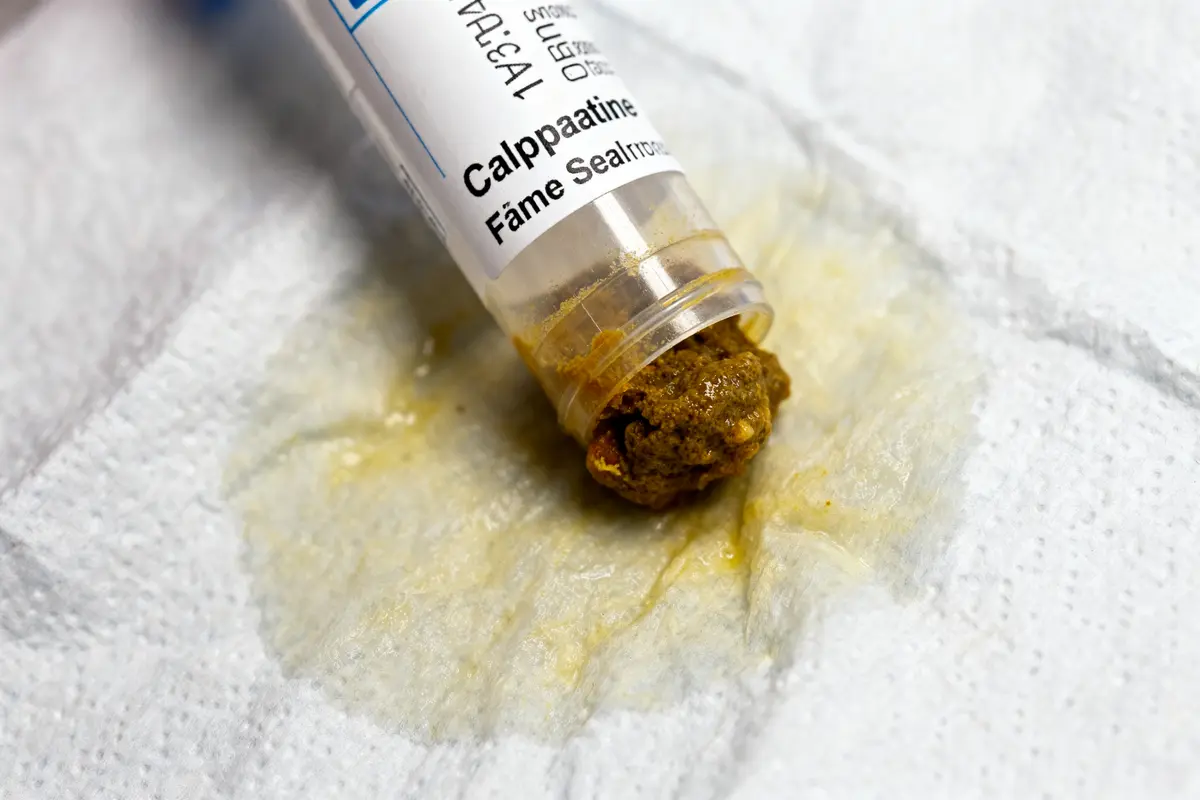 Calprotectine : Comment interpréter un dosage positif ?