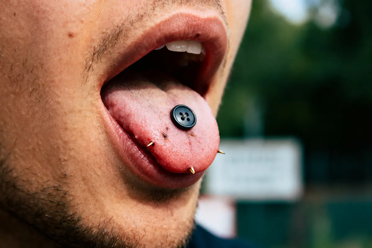 Petit bouton sur la langue qui pique : Causes et solutions ?