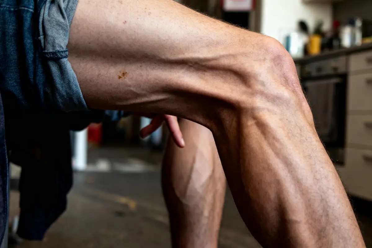 Muscle Qui Bouge Tout Seul : Causes, Symptômes Et Solutions ?